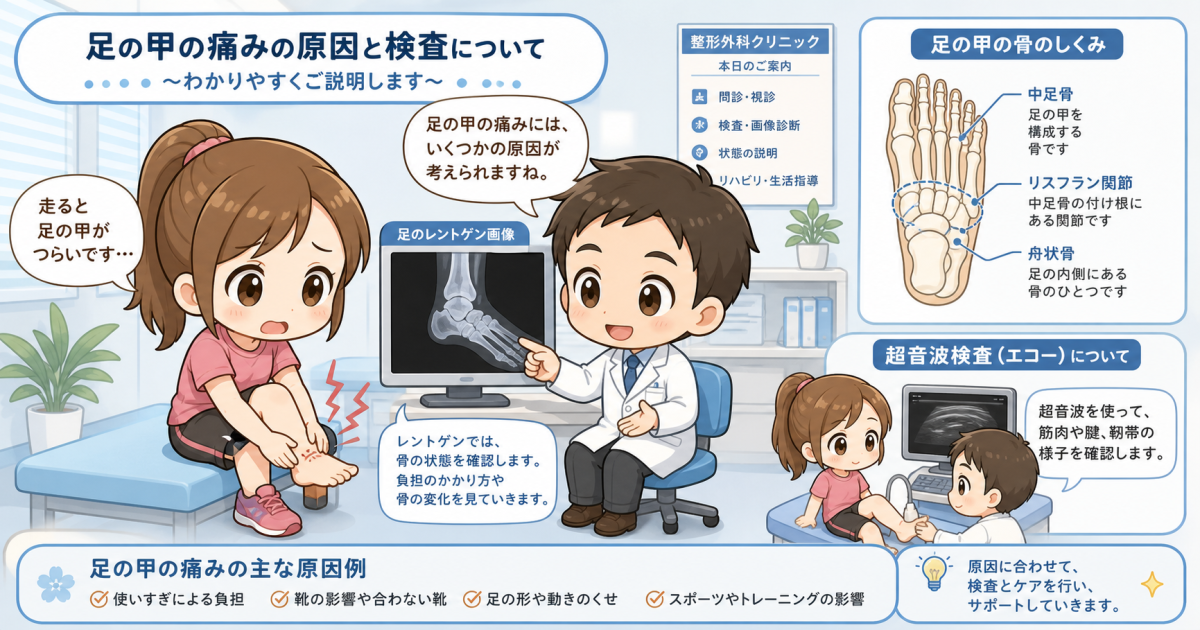 レントゲンで異常なしの足の甲の痛み…疲労骨折を見逃さない受診目安