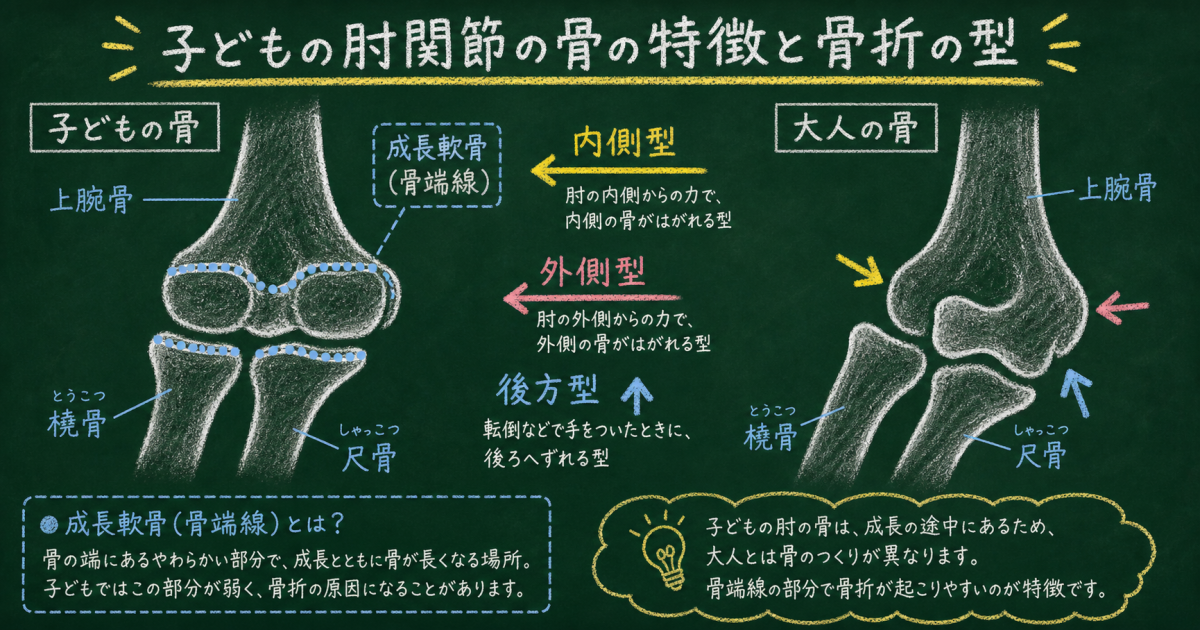 成長期の子どもに起こる投球による肘痛と成長軟骨障害の仕組み