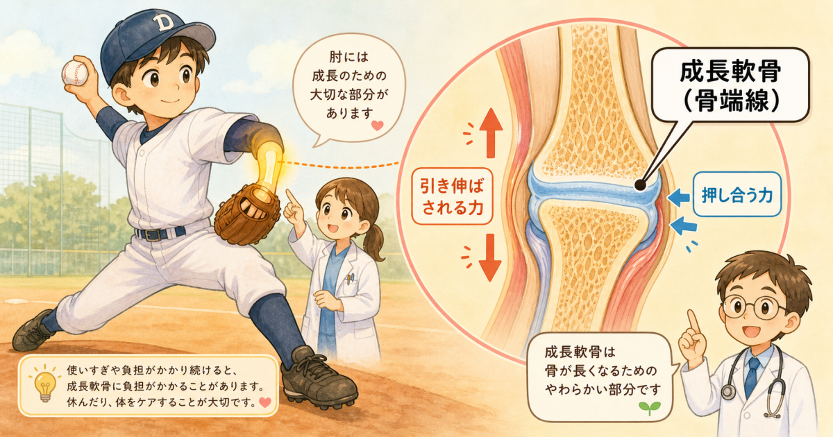 成長期の子どもに起こる投球による肘痛と成長軟骨障害の仕組み